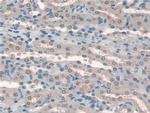 HPS4 Polyclonal Antibody