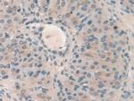 HPS4 Antibody in Immunohistochemistry (Paraffin) (IHC (P))