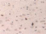 HPS4 Antibody in Immunohistochemistry (Paraffin) (IHC (P))