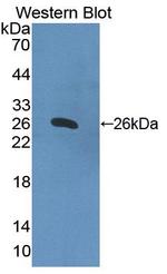 HPS4 Antibody in Western Blot (WB)