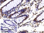 hnRNP A2B1 Antibody in Immunohistochemistry (Paraffin) (IHC (P))