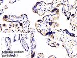 hnRNP A2B1 Antibody in Immunohistochemistry (Paraffin) (IHC (P))