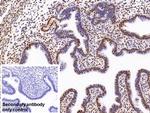 hnRNP A2B1 Antibody in Immunohistochemistry (Paraffin) (IHC (P))