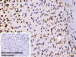 hnRNP A2B1 Antibody in Immunohistochemistry (Paraffin) (IHC (P))