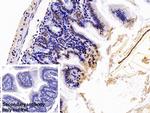 hnRNP A2B1 Antibody in Immunohistochemistry (Paraffin) (IHC (P))