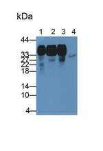 hnRNP A2B1 Antibody in Western Blot (WB)