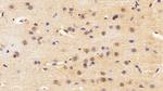 HMGB1 Antibody in Immunohistochemistry (Paraffin) (IHC (P))