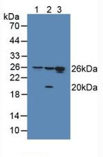 HMGB1 Antibody in Western Blot (WB)