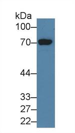 HDC Antibody in Western Blot (WB)