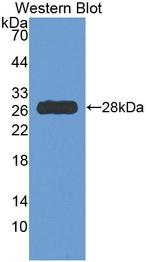 HDC Antibody in Western Blot (WB)