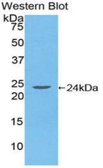 HLA-DRA Antibody in Western Blot (WB)