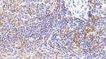 HLA-DRA Antibody in Immunohistochemistry (Paraffin) (IHC (P))