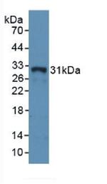 HLA-DRA Antibody in Western Blot (WB)