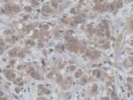 HCFC1 Polyclonal Antibody