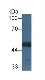 HCFC1 Antibody in Western Blot (WB)