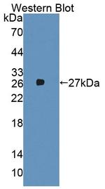 HCFC1 Antibody in Western Blot (WB)