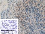 HAO1 Antibody in Immunohistochemistry (Paraffin) (IHC (P))