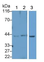 HAO1 Antibody in Western Blot (WB)