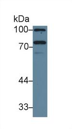 Iduronate 2 Sulfatase Antibody in Western Blot (WB)