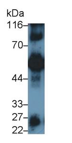 Human IgG4 Antibody in Western Blot (WB)