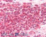 CD275 (B7-H2) Antibody in Immunohistochemistry (Paraffin) (IHC (P))