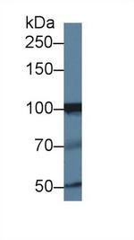 INPP4A Antibody in Western Blot (WB)