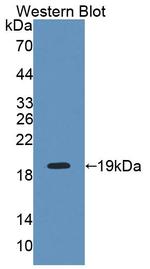 INPP4A Antibody in Western Blot (WB)
