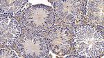 IDE Antibody in Immunohistochemistry (Paraffin) (IHC (P))