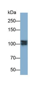 IDE Antibody in Western Blot (WB)