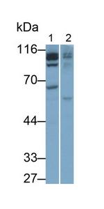 IDE Antibody in Western Blot (WB)