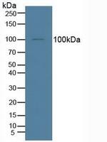IDE Antibody in Western Blot (WB)