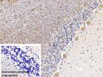 IRS2 Antibody in Immunohistochemistry (Paraffin) (IHC (P))