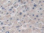 ITIH1 Antibody in Immunohistochemistry (Paraffin) (IHC (P))