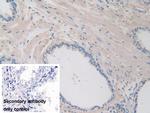 ITIH1 Antibody in Immunohistochemistry (Paraffin) (IHC (P))