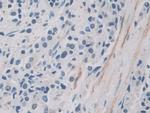 ITIH1 Polyclonal Antibody