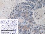 ITIH1 Antibody in Immunohistochemistry (Paraffin) (IHC (P))