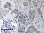 ITIH1 Antibody in Immunohistochemistry (Paraffin) (IHC (P))