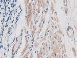 ITIH1 Antibody in Immunohistochemistry (Paraffin) (IHC (P))