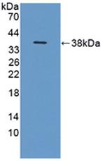 ITIH1 Antibody in Western Blot (WB)