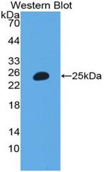 ITIH3 Antibody in Western Blot (WB)