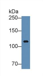 ITIH3 Antibody in Western Blot (WB)