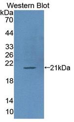 CD50 (ICAM-3) Antibody in Western Blot (WB)