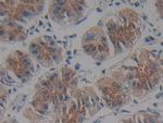 IFNAR2 Antibody in Immunohistochemistry (Paraffin) (IHC (P))