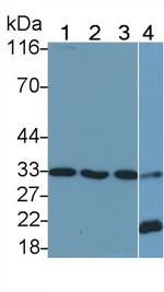 IFNAR2 Antibody in Western Blot (WB)