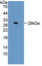 IFNAR2 Antibody in Western Blot (WB)