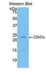 IL-1 beta Antibody in Western Blot (WB)