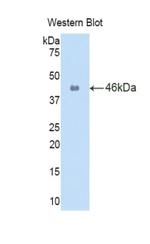 IL-1 beta Antibody in Western Blot (WB)