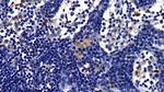 IL1R1 Antibody in Immunohistochemistry (Paraffin) (IHC (P))