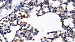 IL1R1 Antibody in Immunohistochemistry (Paraffin) (IHC (P))