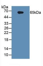 IL1R1 Antibody in Western Blot (WB)